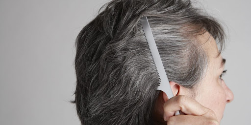 درمان سفیدی مو در طب سنتی ، علت سفید شدن زودرس مو