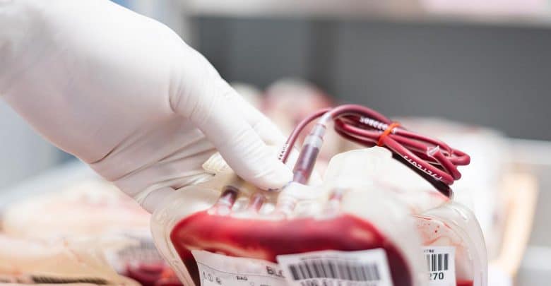 تفاوت اهدای خون و حجامت